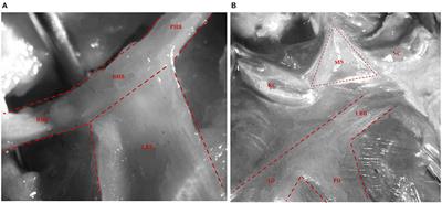 Left Bundle Branch Pacing: Current Knowledge and Future Prospects